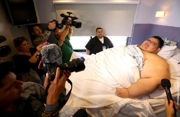 Мексиканац Хуан Педро Франко, тежак 595 килограма, најгојазнији човек на свету, у болници у Гвадалахари, 17. маја 2017. 