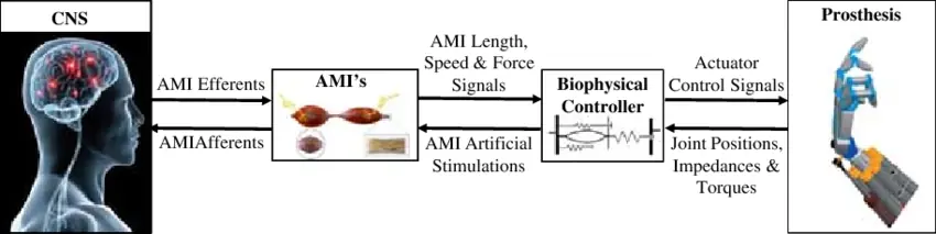 Agonist antagonist mionural interfejs- AMI