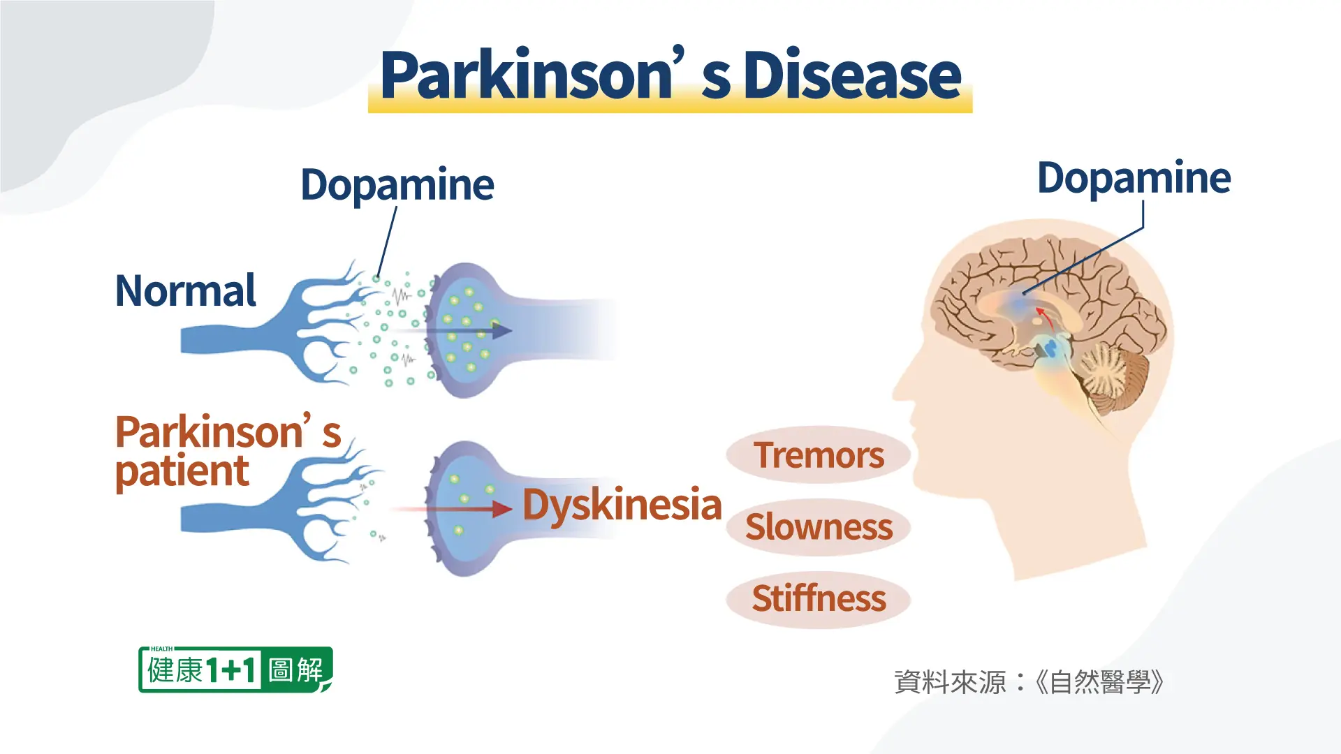 Dopamin kod ljudi sa Parkinsonovom bolešću